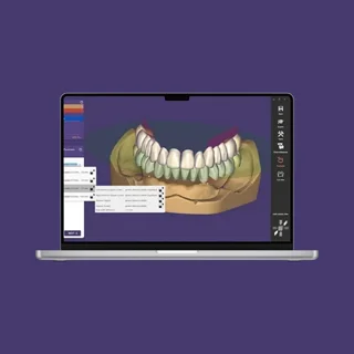 نرم افزار اگزوکد3.0 | exocad 3.0